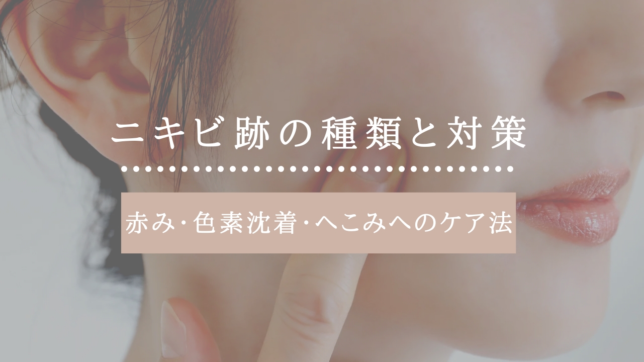 ニキビ跡種類のアイキャッチ